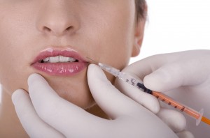 Aumento de labios