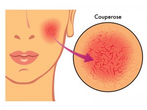 Masaje relajante Hot Karité CV