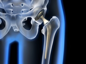 Fisioterapia