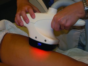 Velashape II