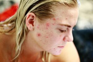 Dermatología